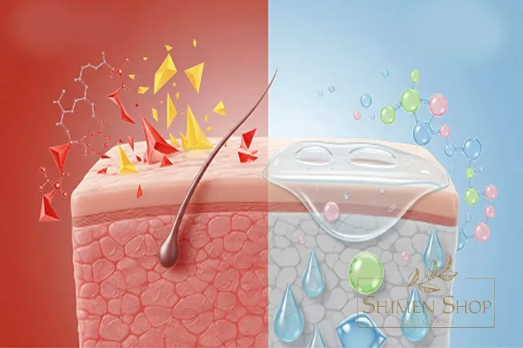چرا ماسک کره‌ای برای پوست دارای جوش مناسب است؟