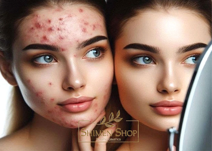 بهترین ژل شستشوی پوست چرب