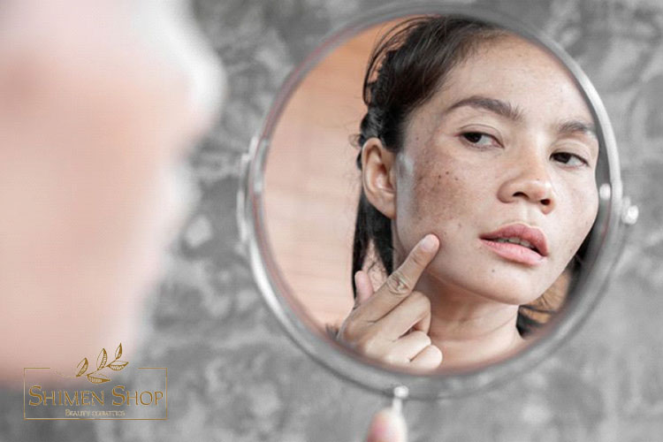 علت ایجاد لک پوستی چیست؟