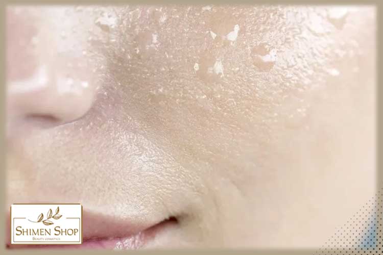 آیا آبرسان منافذ پوست را باز می‌کند؟