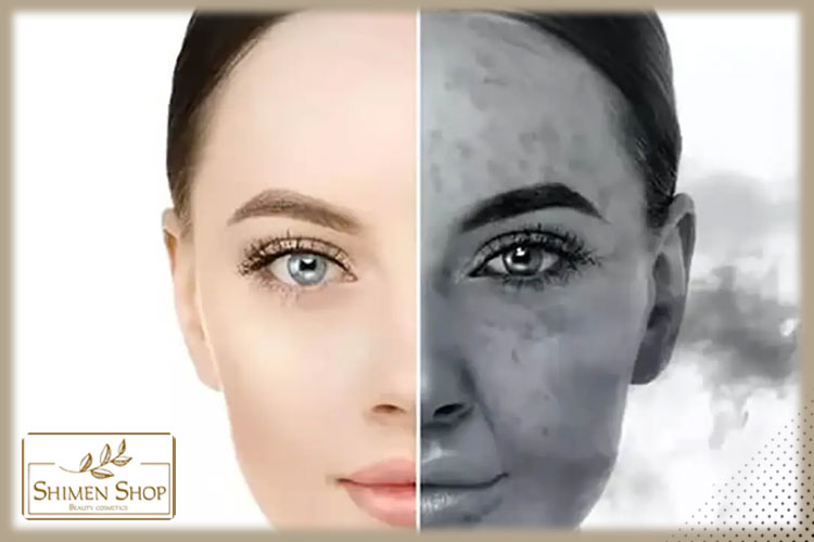 آلودگی هوا چه تأثیری بر پوست دارد؟