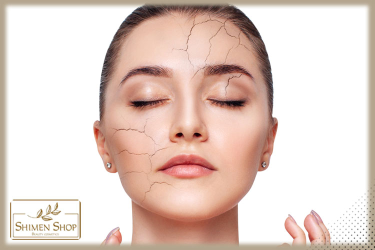 پوست خشک با پوست دهیدراته چه تفاوتی دارد؟