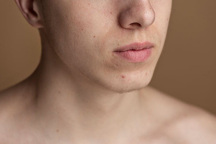 تشخیص علت خشکی پوست
