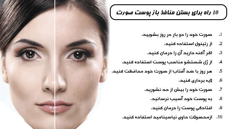 10 راه برای بستن منافذ باز پوست صورت