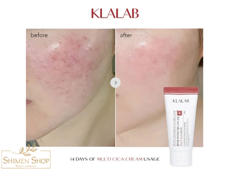 کرم مرطوب کننده و ترمیم کننده چندمنظوره سیکا کلالب 80 میل