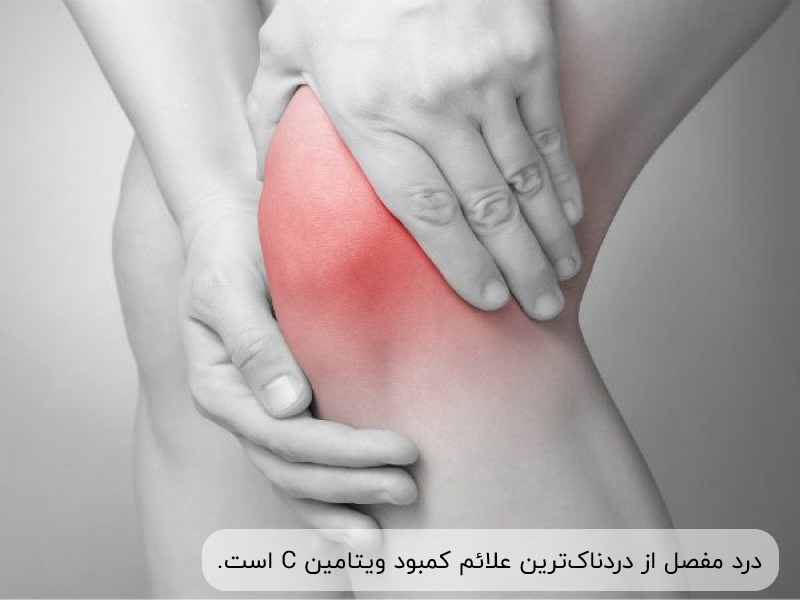 درد مفصل مانند مفصل زانو می‌تواند از علائم کمبود ویتامین سی باشد.